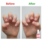 Anti-Nail Biting Treatment – 15ml Bitter Formula for Thumb Sucking & Nail Care